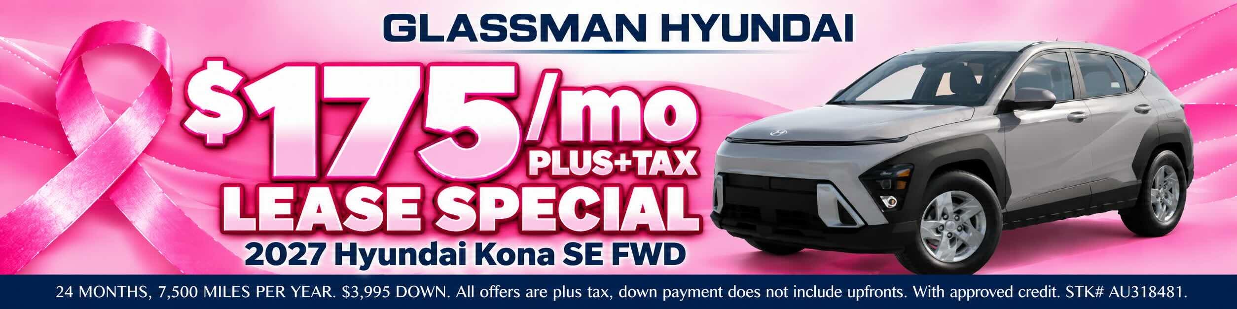 OCT Hyundai lease