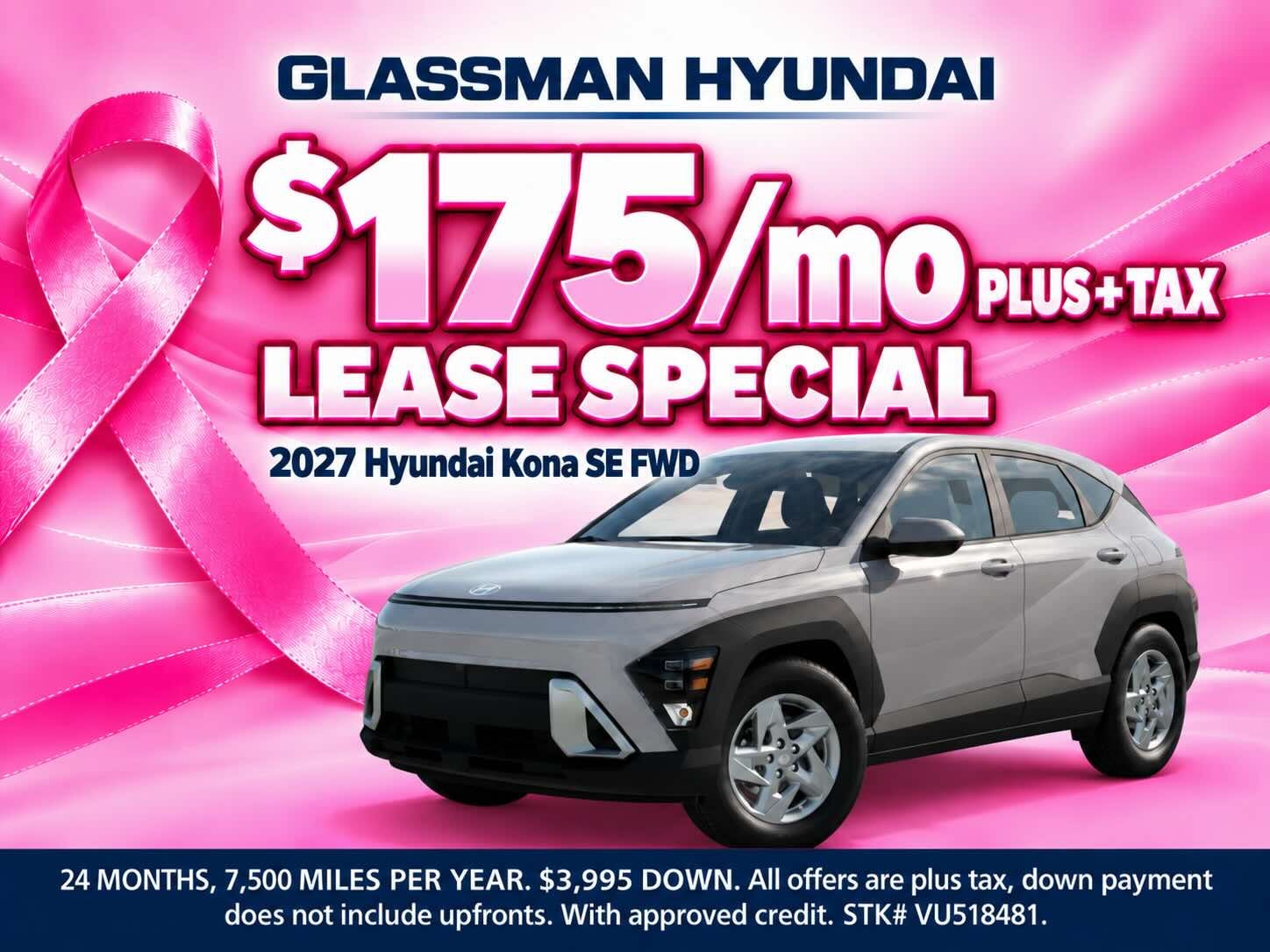 OCT Hyundai lease